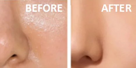 How do I stop my skin from getting oily? Try this best selling oil-control face powder by Mattify Cosmetics Vegan Makeup. You can see the difference in this before and after picture. Our transparent matte face powder blots away oil, for a clean poreless look. 