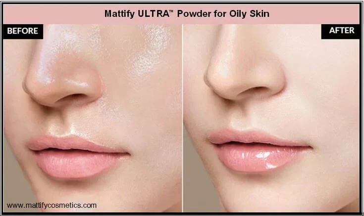oil control face powder, powder for oily skin, mattify ULTRA powder, vegan makeup, makeup for sensitive skin, white setting powder, matte face powder, how to stop oily skin, powder without talc, shine control powder, before and after face powder, products for oily skin,  makeup for oily skin, mattify cosmetics 
