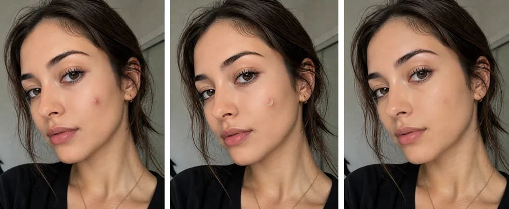 How to hide acne with concealer by placing it underneath to hide the shadow caused by the breakout - before and after makeup for acne prone skin SFX professional Hollywood foundation tips  Mattify Cosmetics