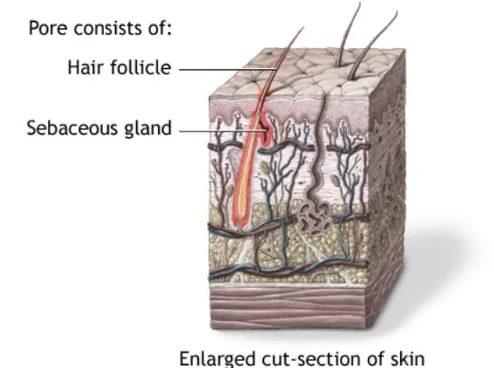 What causes acne and how does a zit form under the skin, learn how blackheads turn into breakouts and scientific information on acne 